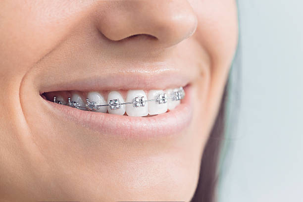 Laser Dentistry in Amherst, OH